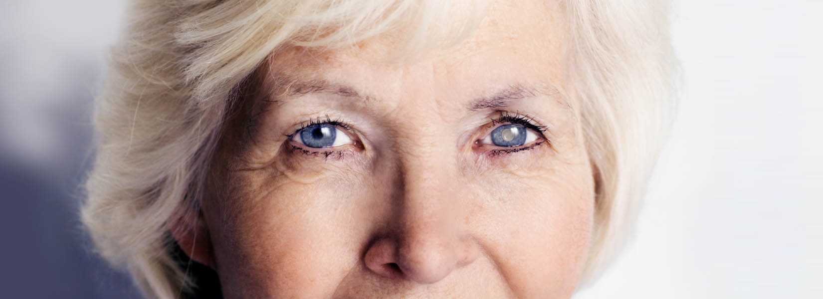 Cataract Surgery in Crossroads