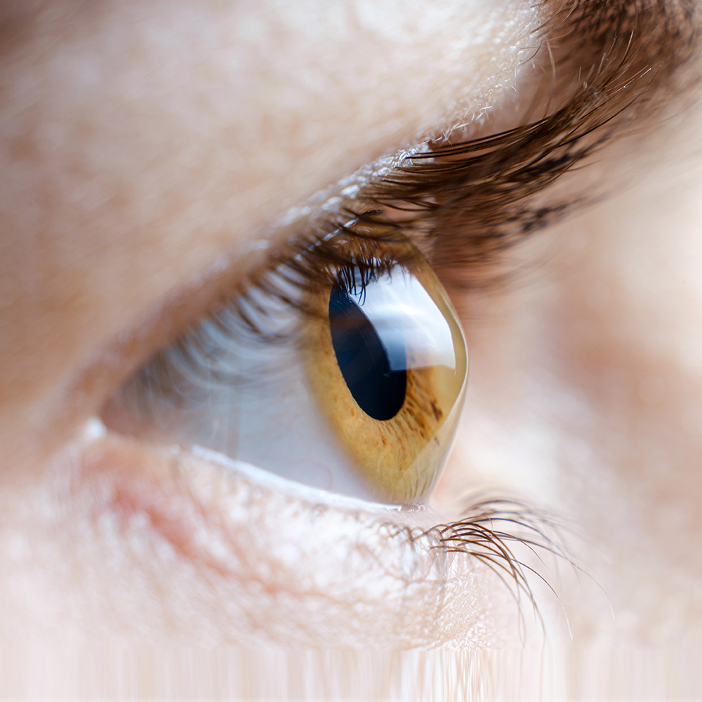 Keratoconus Treatment in Crossroads